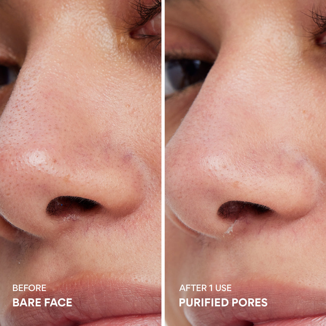 Super Volcanic Pore Clay Mask – Deep Cleanse & Clear Face Pores
